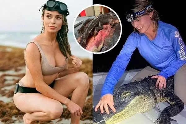 Mulher conhecida como a cientista mais bonita do mundo mostra sintomas da doença.