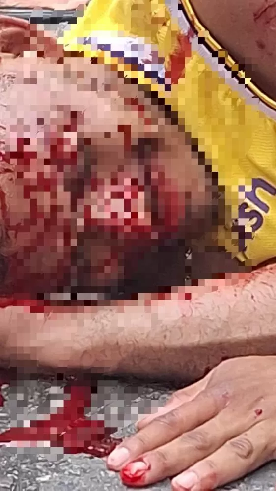 Acidente aconteceu na Avenida Itaúba, no bairro Jorge Teixeira, na zona leste da capital