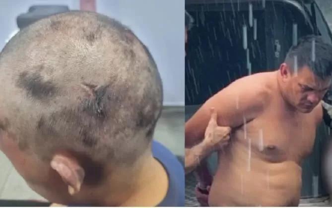 Homem que raspou cabeça de mulher em Manaus a atraiu usando desculpa da pensão alimentícia.