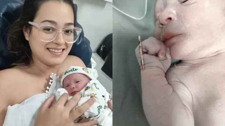 Bebê nasce com DIU após gravidez rara em SP: “Menino lindo e saudável”