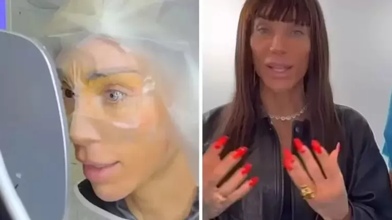 Maya Massafera faz cirurgia para mudar cor dos olhos