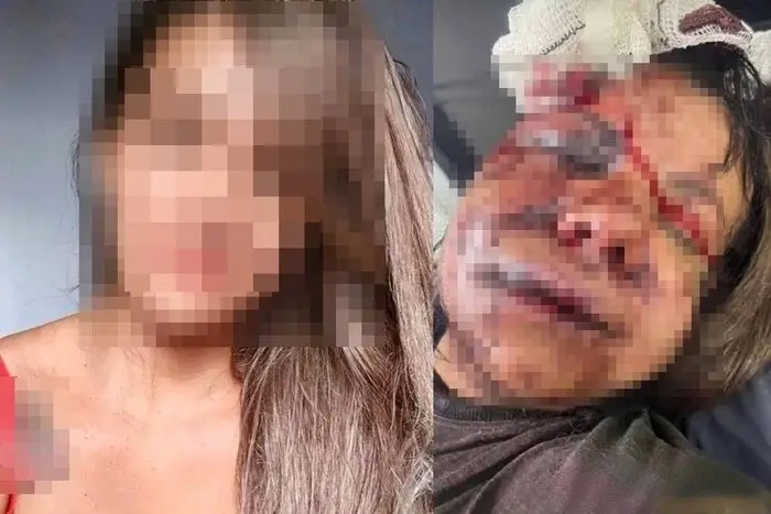 Mulher tem o rosto desfigurado após agressão brutal de ex-jogador de basquete em condomínio de luxo
