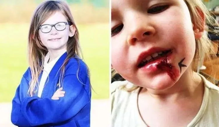 Menina britânica desafia a ciência ao viver sem sentir dor, fome ou cansaço